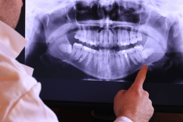 Best Emergency Broken Tooth Repair in Four Bridges, OH