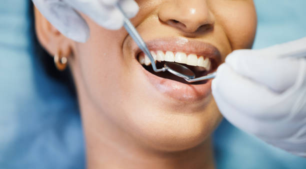 Best Emergency Broken Tooth Repair in Four Bridges, OH