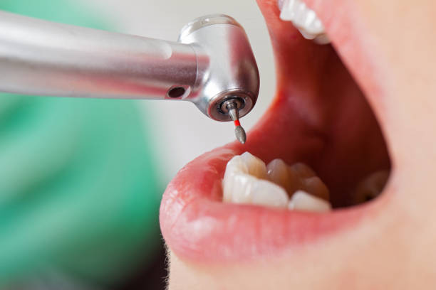 Best After-Hours Emergency Dentist in Four Bridges, OH
